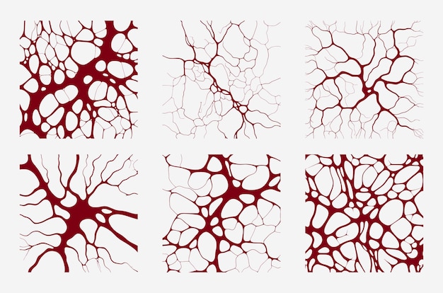 Rozszerzone naczynka na twarzy: Klucz do zdrowej skóry